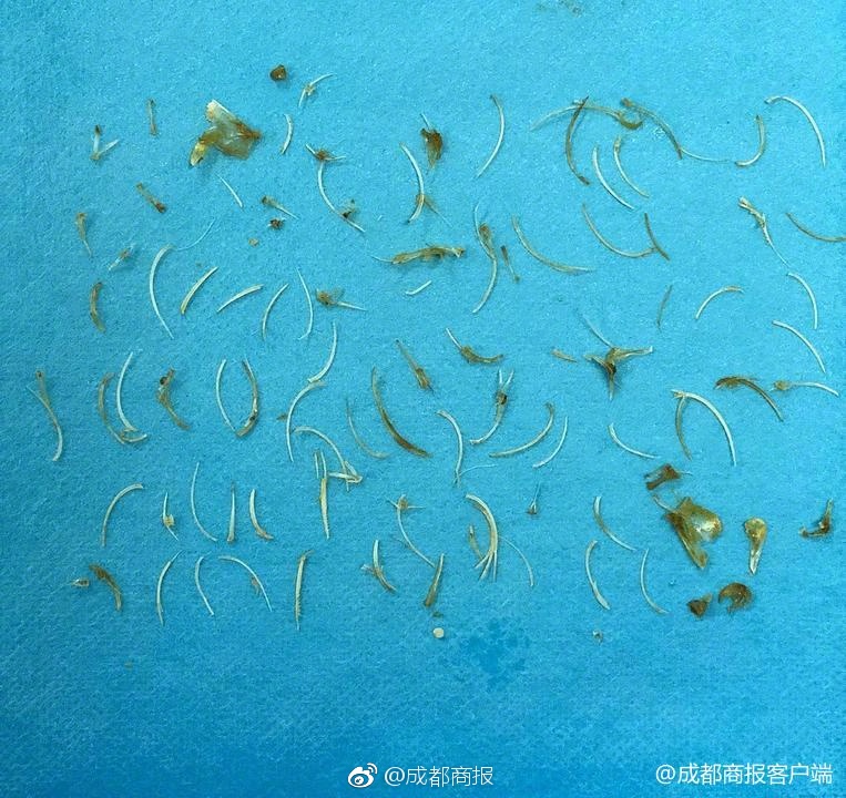 “中国文化进校园”活动 在摩洛哥举办