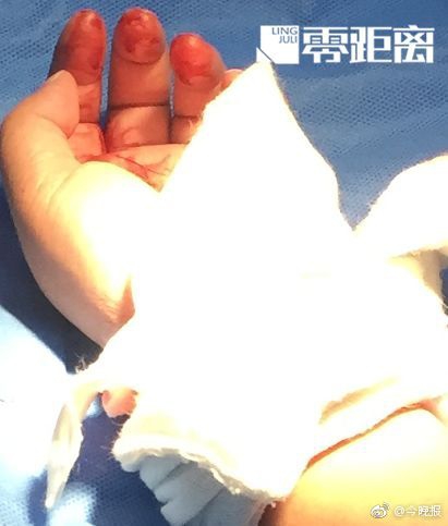 黄山市屯溪区大众大舞台唱响黄山“好声响”