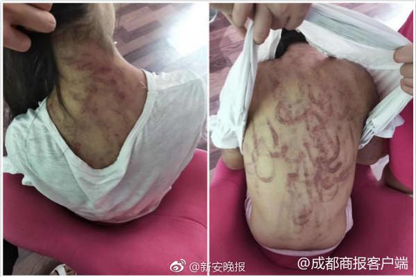 澳波：我们让自己面前出现一座高山要攀登，我承担输球的责任
